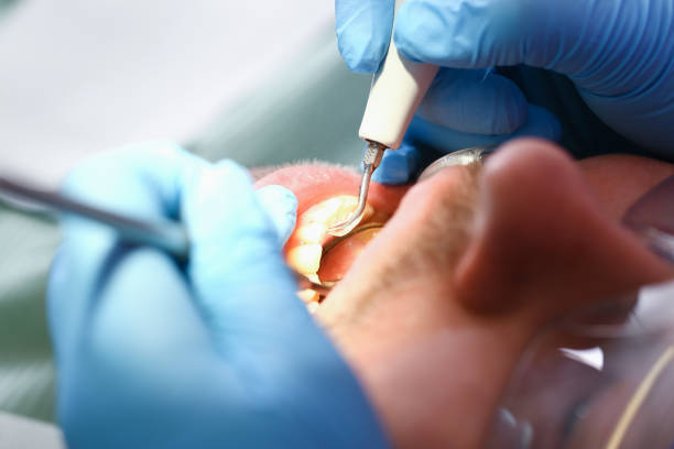 Best Emergency Cosmetic Dentistry (e.g., broken veneers) in Rural Hall, NC